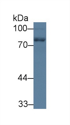 Polyclonal Antibody to Neurofilament, Light Polypeptide (NEFL)