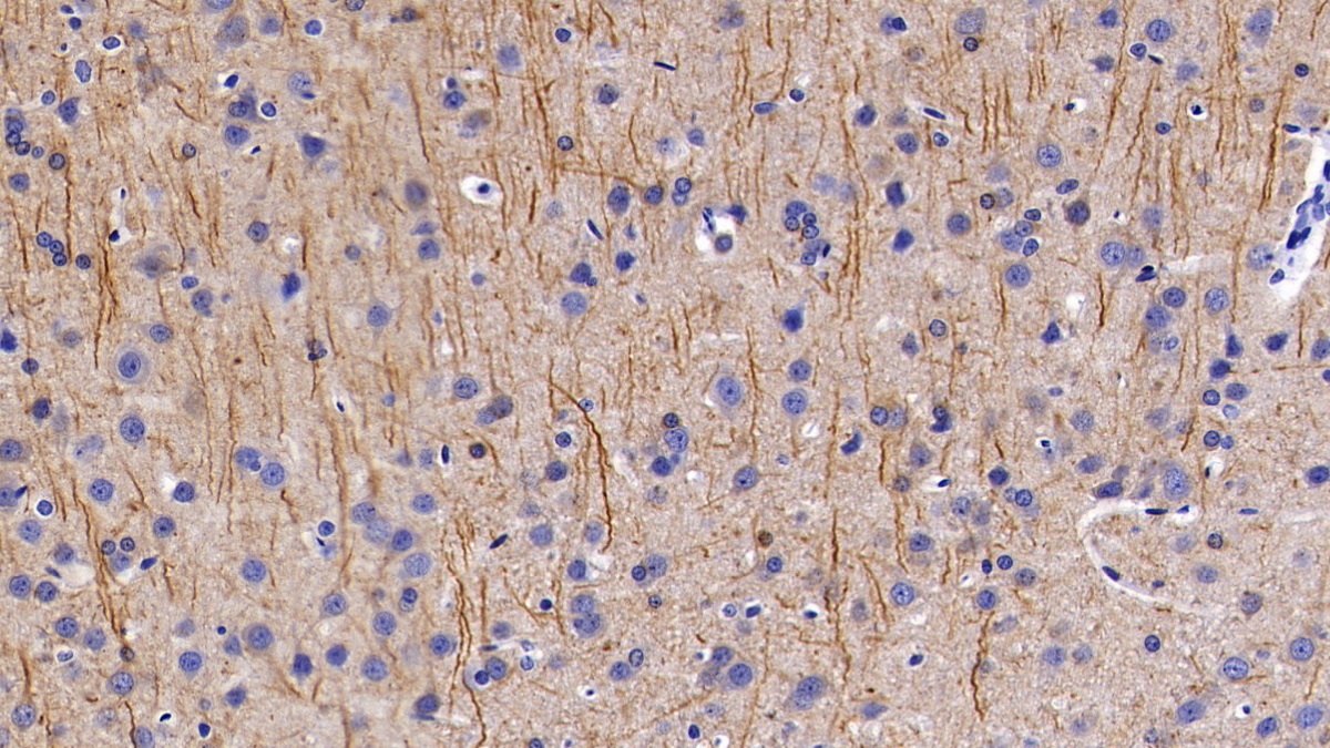 Polyclonal Antibody to Neurofilament, Light Polypeptide (NEFL)