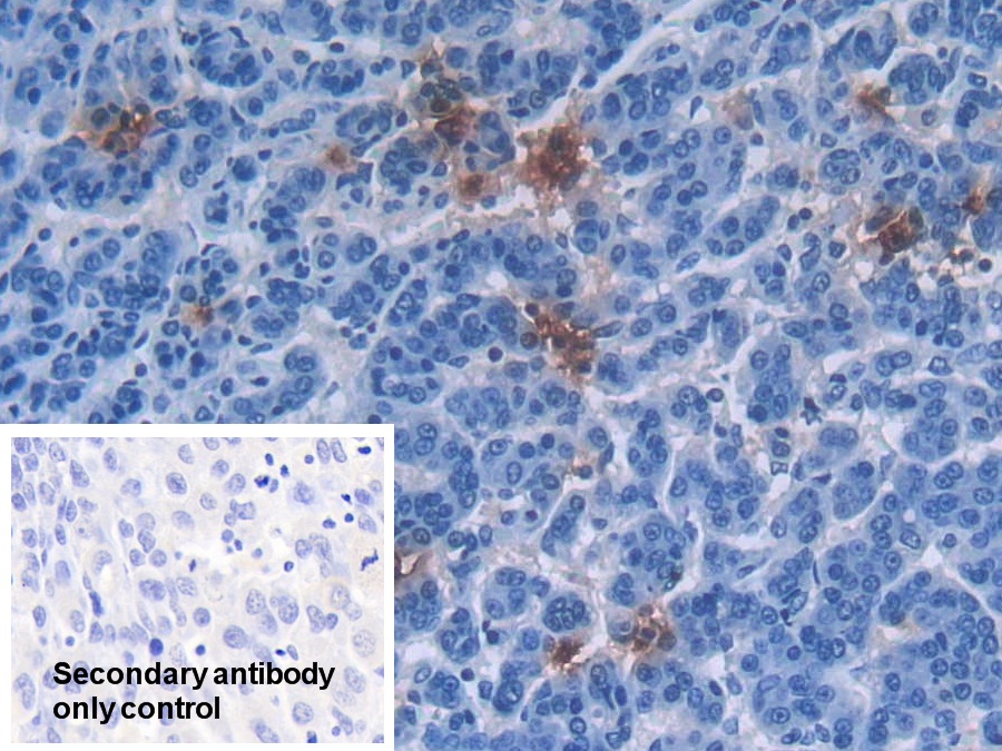 Polyclonal Antibody to Defensin Alpha 3, Neutrophil Specific (DEFa3)
