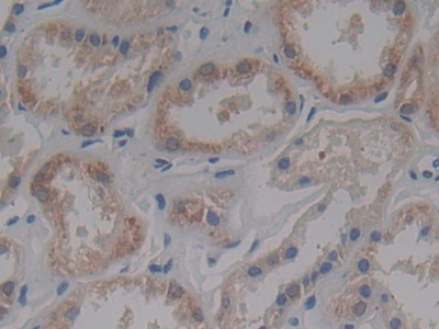 Polyclonal Antibody to Interferon Alpha/Beta Receptor 2 (IFNa/bR2)