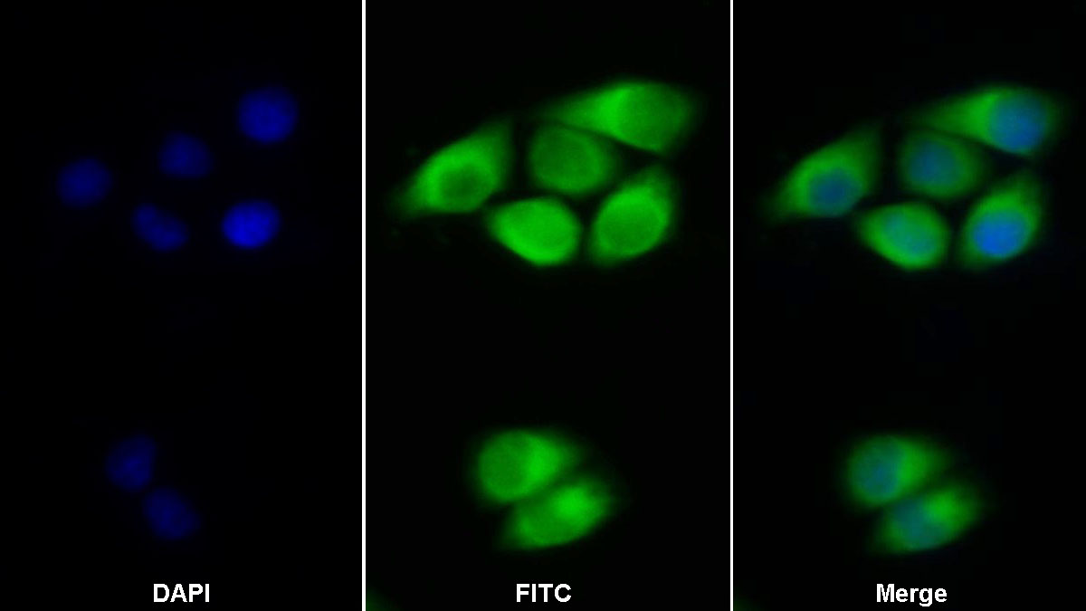 Polyclonal Antibody to Interferon Alpha/Beta Receptor 2 (IFNa/bR2)