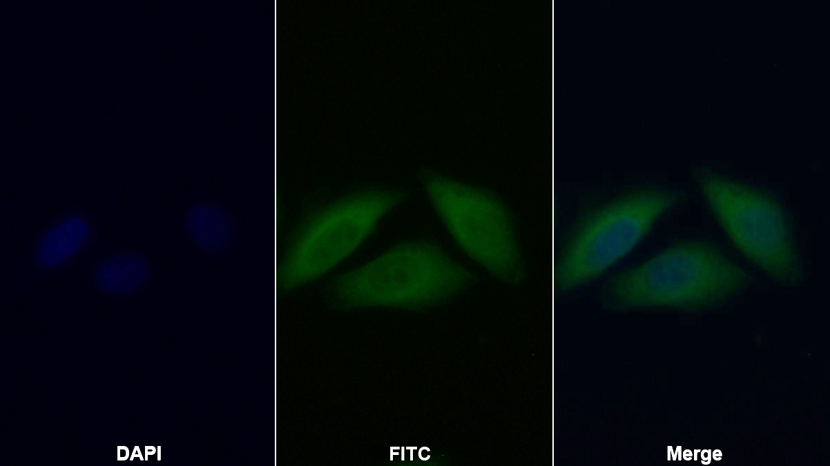 Polyclonal Antibody to Interferon Alpha/Beta Receptor 2 (IFNa/bR2)