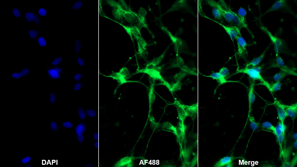Polyclonal Antibody to Proprotein Convertase Subtilisin/Kexin Type 9 (PCSK9)