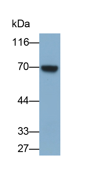 Polyclonal Antibody to Proprotein Convertase Subtilisin/Kexin Type 9 (PCSK9)