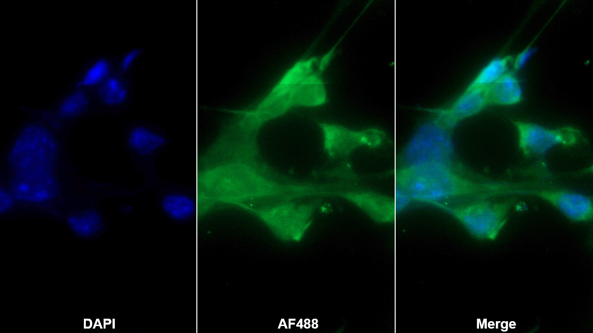 Polyclonal Antibody to Proprotein Convertase Subtilisin/Kexin Type 9 (PCSK9)