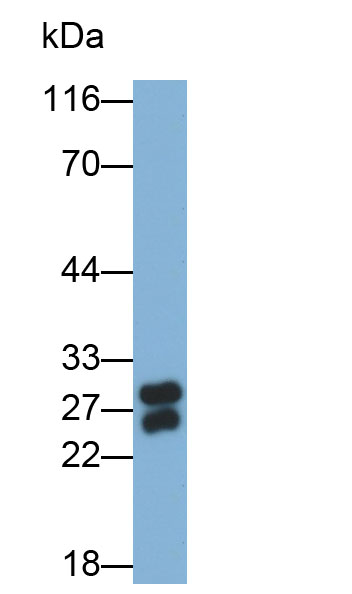 Polyclonal Antibody to Elastase 3B (ELA3B)