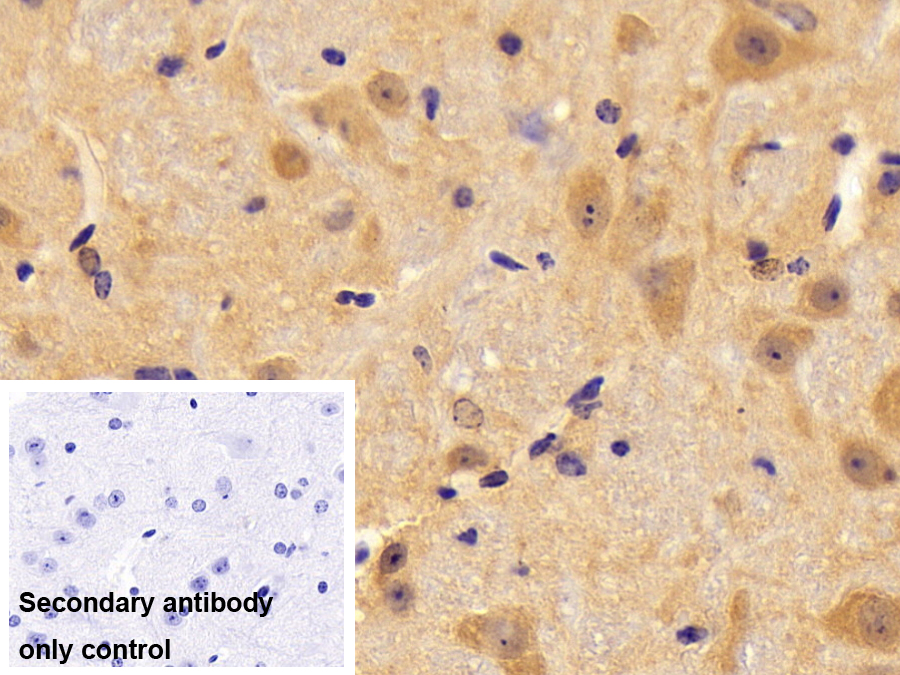 Polyclonal Antibody to Peptidyl Prolyl Cis/Trans Isomerase NIMA Interacting Protein 1 (PIN1)