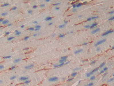 Polyclonal Antibody to Muscle, Skeletal, Receptor Tyrosine Kinase (MUSK)