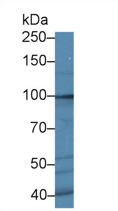 Polyclonal Antibody to Receptor Tyrosine Kinase Like Orphan Receptor 2 (ROR2)