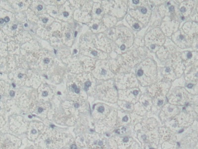 Polyclonal Antibody to Receptor Tyrosine Kinase Like Orphan Receptor 2 (ROR2)