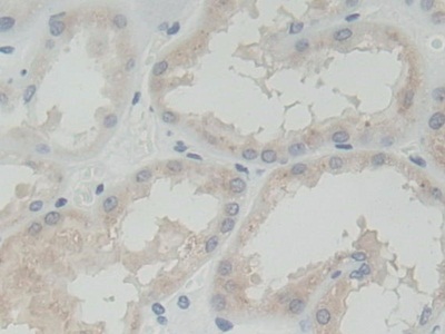 Polyclonal Antibody to Receptor Tyrosine Kinase Like Orphan Receptor 2 (ROR2)