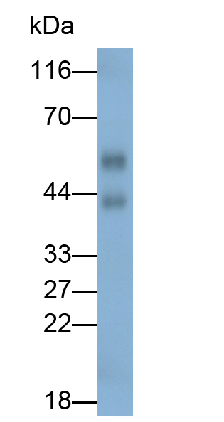 Polyclonal Antibody to Endothelial Cell Adhesion Molecule (ESAM)
