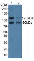 Polyclonal Antibody to Neural Cell Adhesion Molecule 2 (NCAM2)