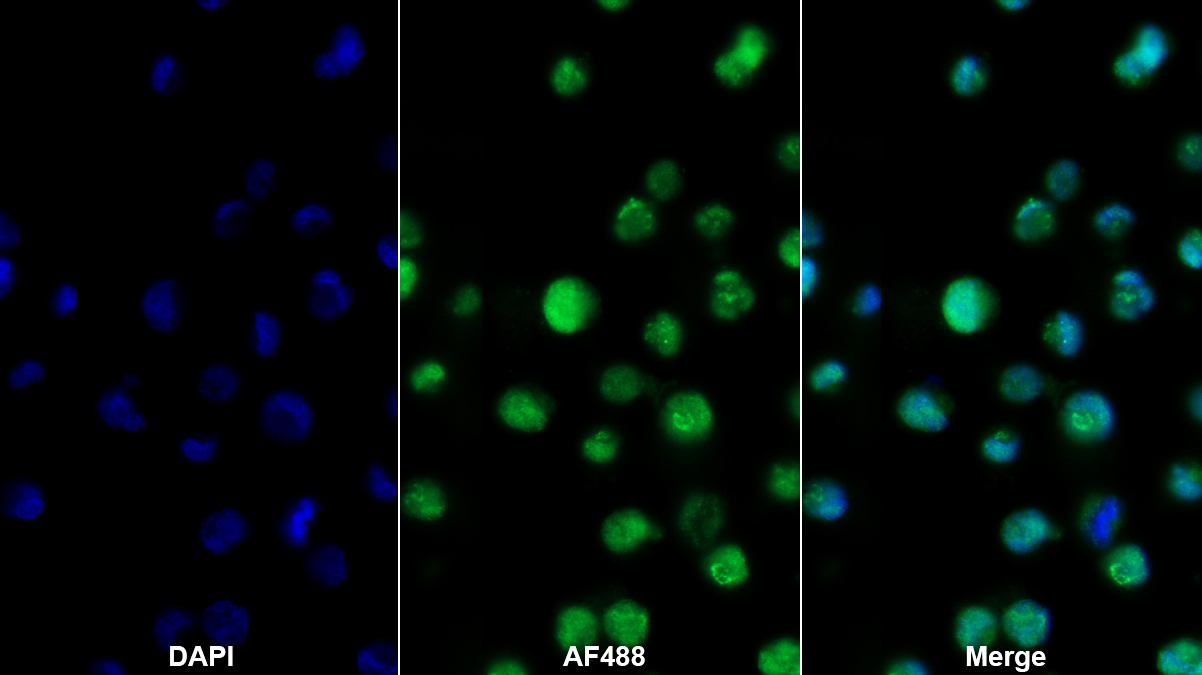 Polyclonal Antibody to TATA Box Binding Protein Associated Factor 12 (TAF12)