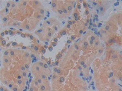 Polyclonal Antibody to Glycoprotein 2, Zymogen Granule Membrane (GP2)