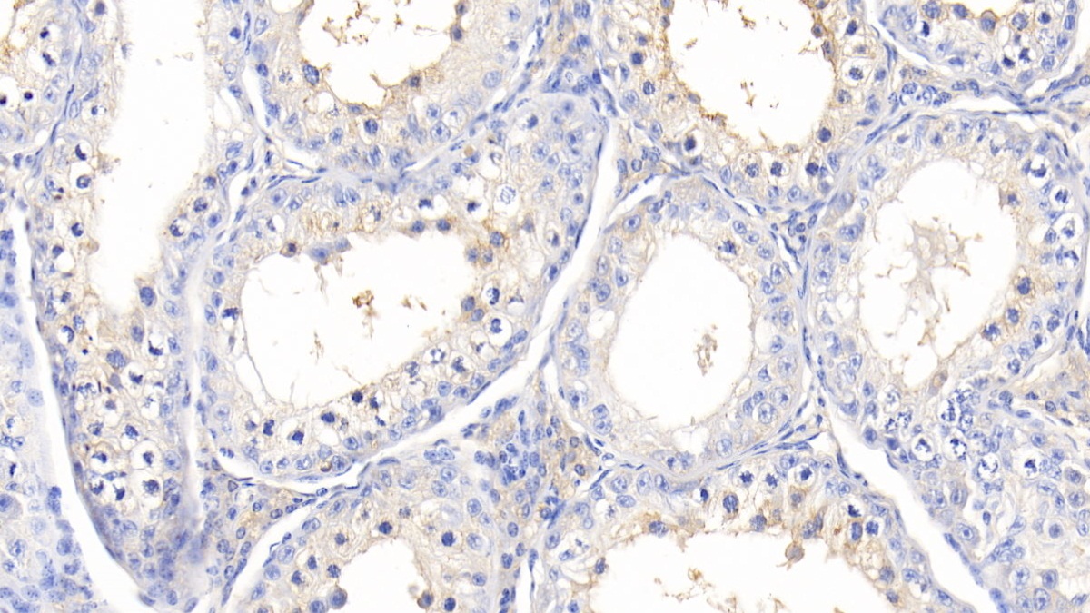 Polyclonal Antibody to Alpha-1-B-Glycoprotein (a1BG)