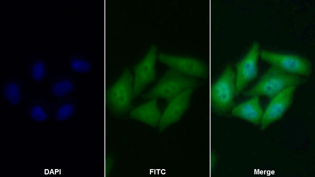 Polyclonal Antibody to B-Cell CLL/Lymphoma 2 Like Protein (Bcl2L)