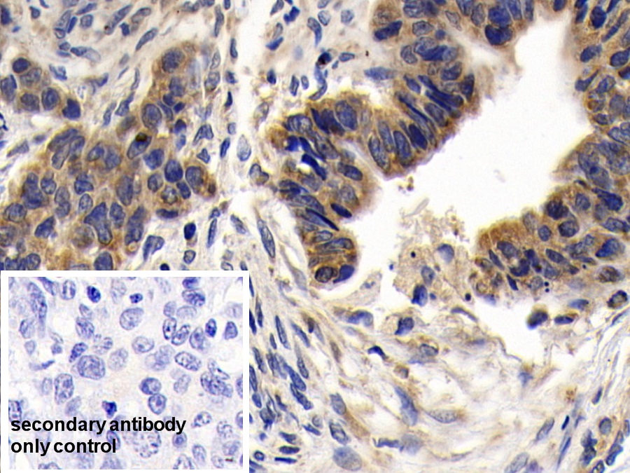 Polyclonal Antibody to B-Cell CLL/Lymphoma 2 Like Protein (Bcl2L)