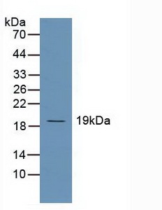 Polyclonal Antibody to Ubiquitin Conjugating Enzyme E2C (UBE2C)