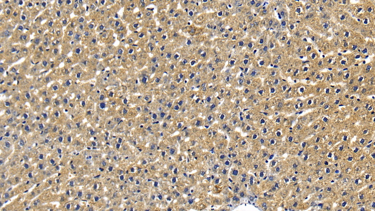 Polyclonal Antibody to Receptor Interacting Serine Threonine Kinase 1 (RIPK1)