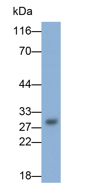 Polyclonal Antibody to FK506 Binding Protein 7 (FKBP7)