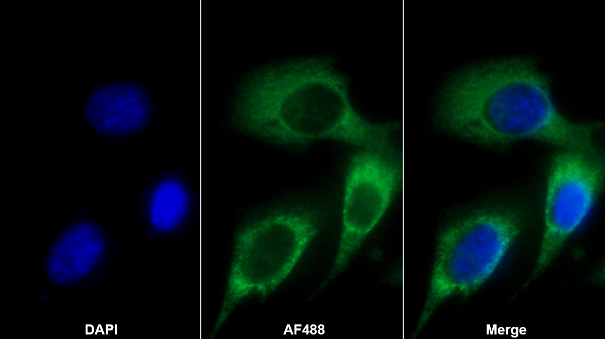Polyclonal Antibody to FK506 Binding Protein 10 (FKBP10)