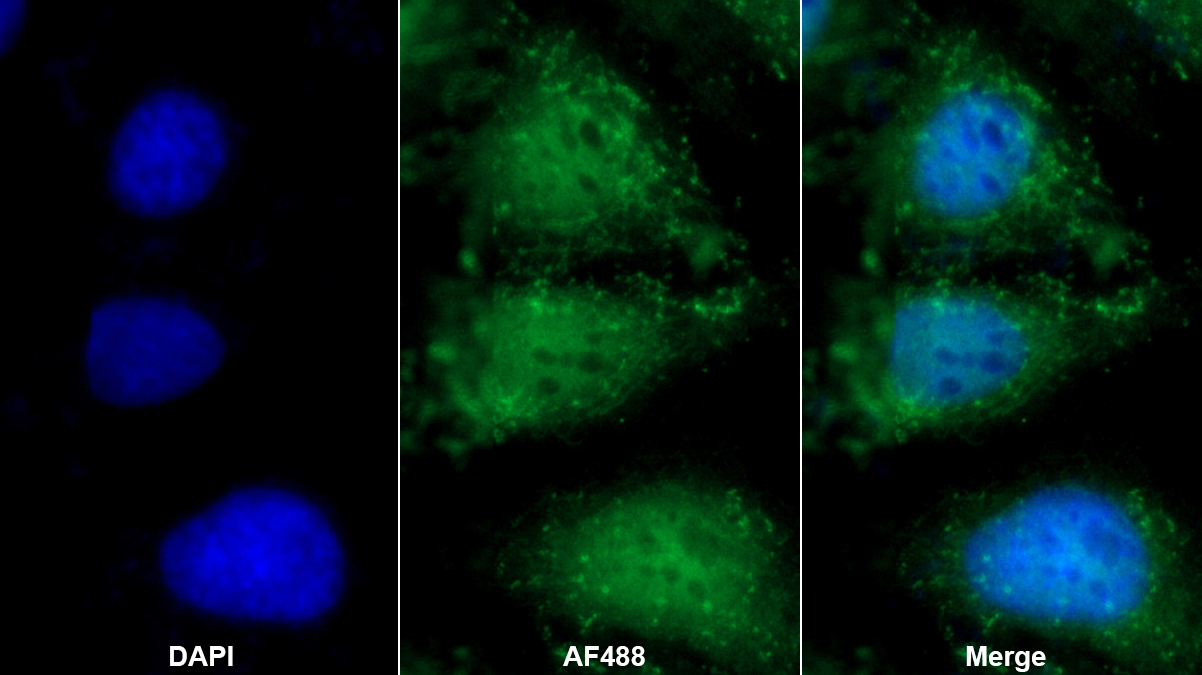 Polyclonal Antibody to Sphingosine Kinase 1 (SPHK1)