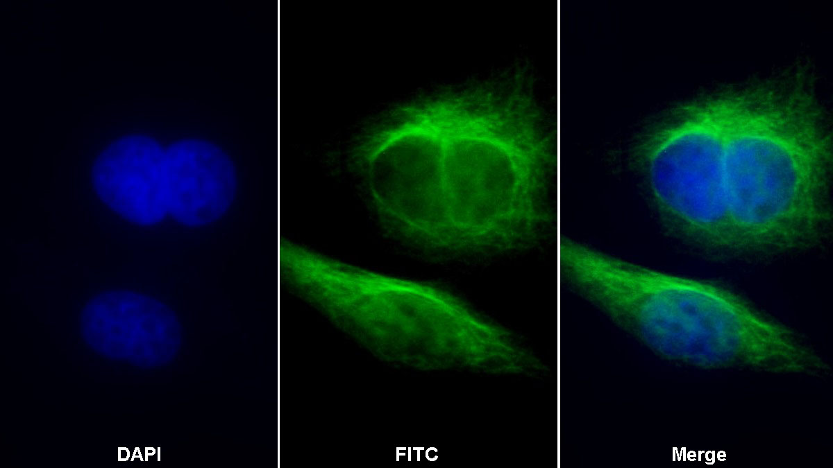 Polyclonal Antibody to Tubulin Beta 1 (TUBb1)