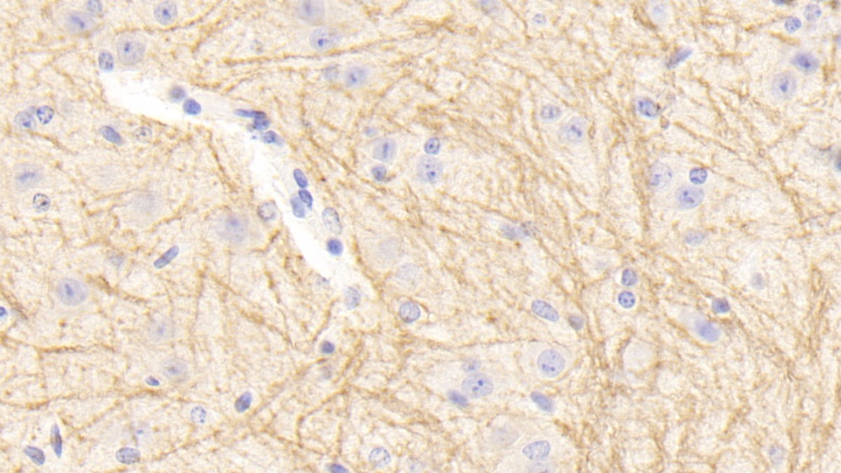 Polyclonal Antibody to Tubulin Beta 1 (TUBb1)