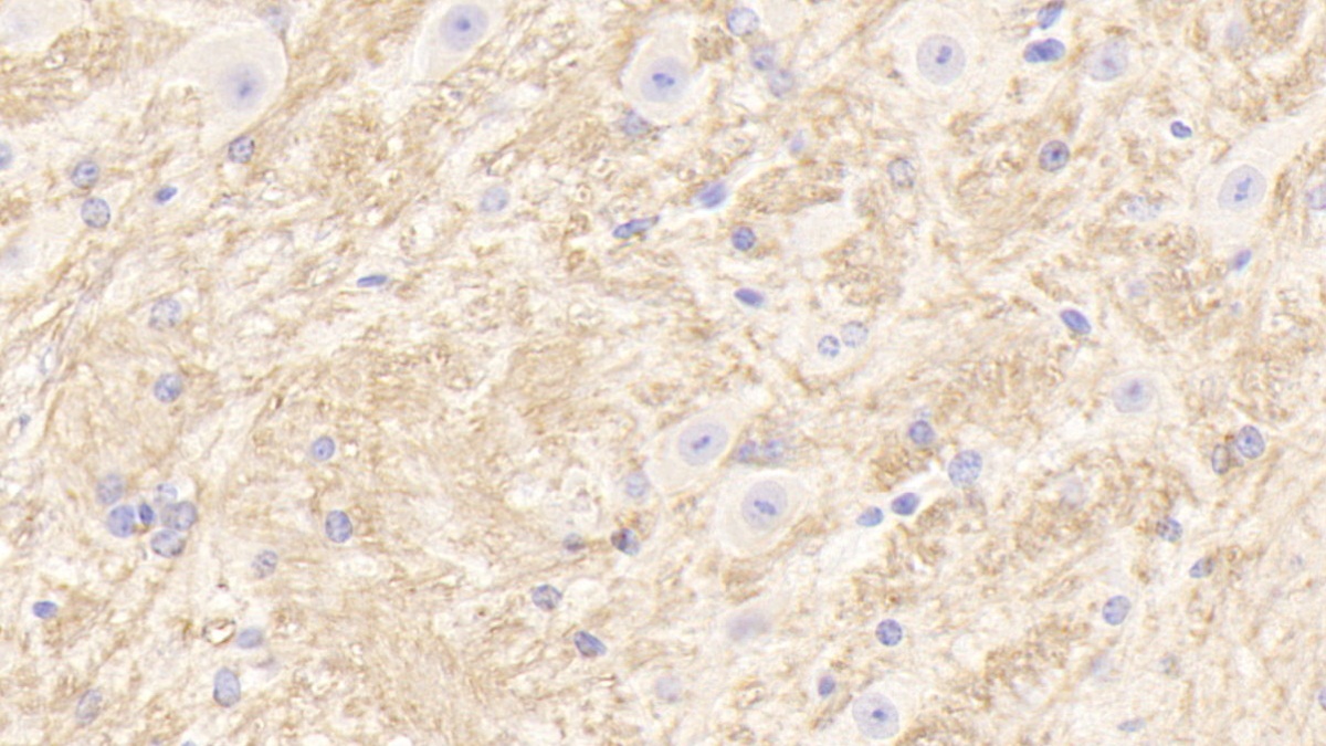 Polyclonal Antibody to Tubulin Beta 1 (TUBb1)