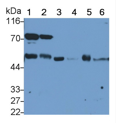 Polyclonal Antibody to Tubulin Beta 3 (TUBb3)