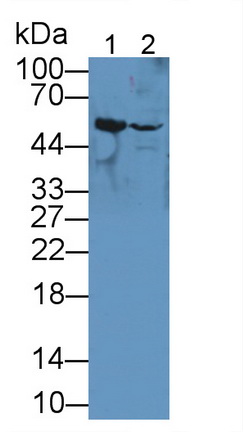 Polyclonal Antibody to Tubulin Beta 6 (TUBb6)