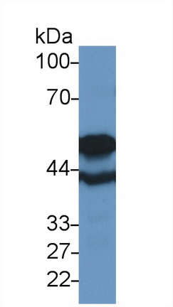 Polyclonal Antibody to Tubulin Beta 6 (TUBb6)