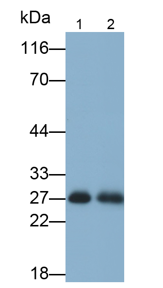 Polyclonal Antibody to Tubulin Folding Cofactor B (TBCB)