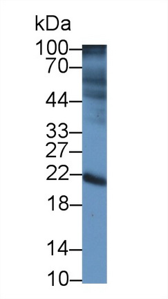 Polyclonal Antibody to Interleukin 22 Receptor Alpha 2 (IL22Ra2)