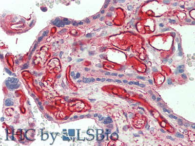 Polyclonal Antibody to Interleukin 22 Receptor Alpha 2 (IL22Ra2)