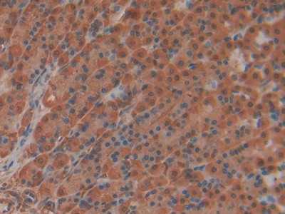 Polyclonal Antibody to Interleukin 22 Receptor Alpha 2 (IL22Ra2)