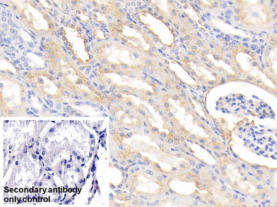 Polyclonal Antibody to Annexin A4 (ANXA4)