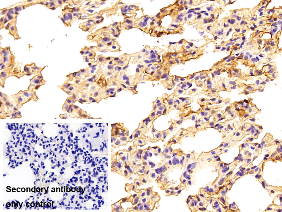 Polyclonal Antibody to Annexin A4 (ANXA4)