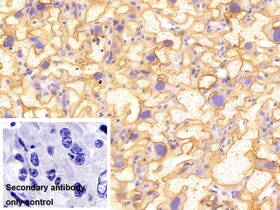 Polyclonal Antibody to Annexin A4 (ANXA4)
