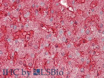 Polyclonal Antibody to Annexin A4 (ANXA4)