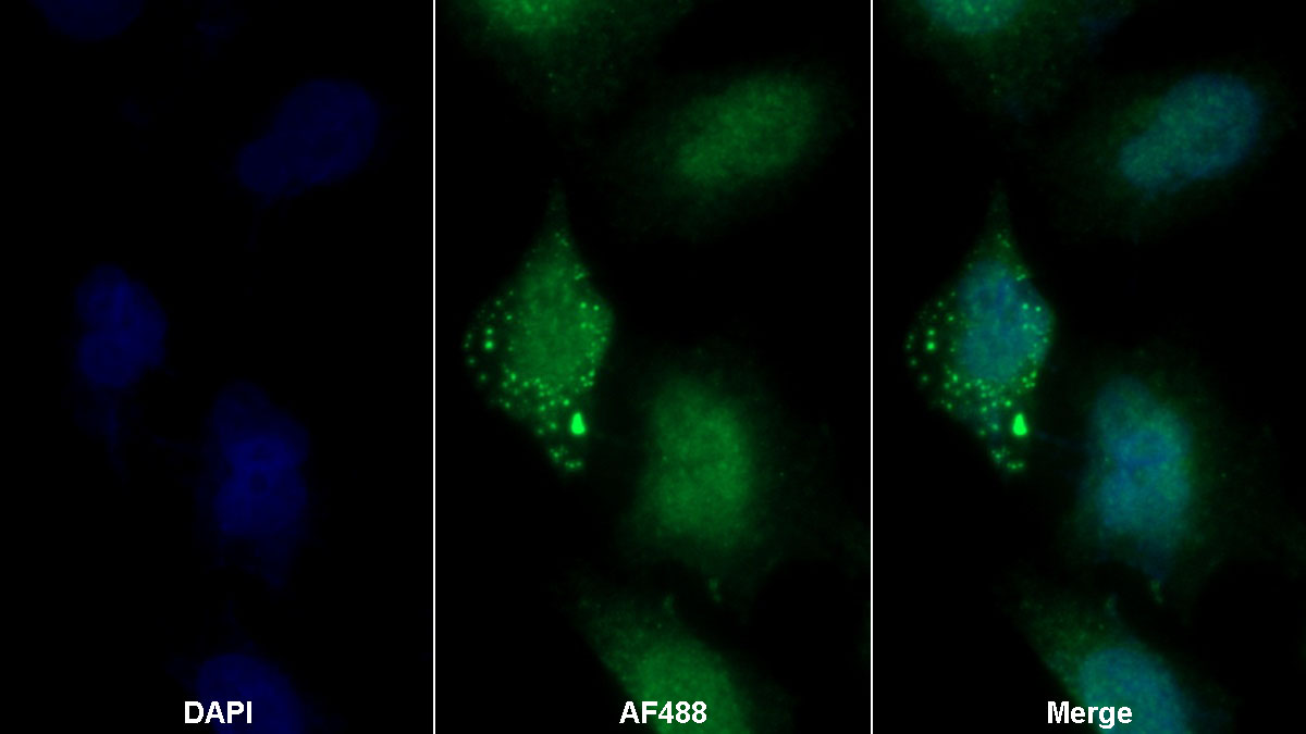 Polyclonal Antibody to Annexin A4 (ANXA4)