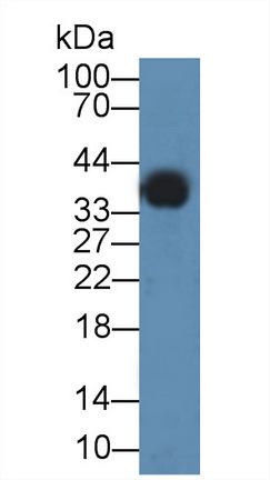 Polyclonal Antibody to Annexin A3 (ANXA3)