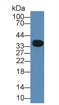 Polyclonal Antibody to Annexin A3 (ANXA3)