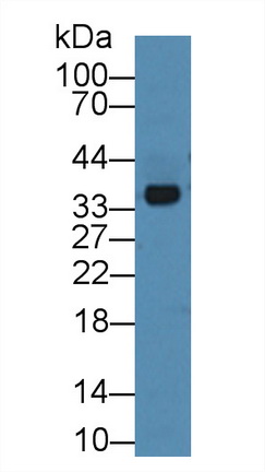 Polyclonal Antibody to Annexin A3 (ANXA3)