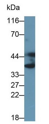 Polyclonal Antibody to Annexin A3 (ANXA3)