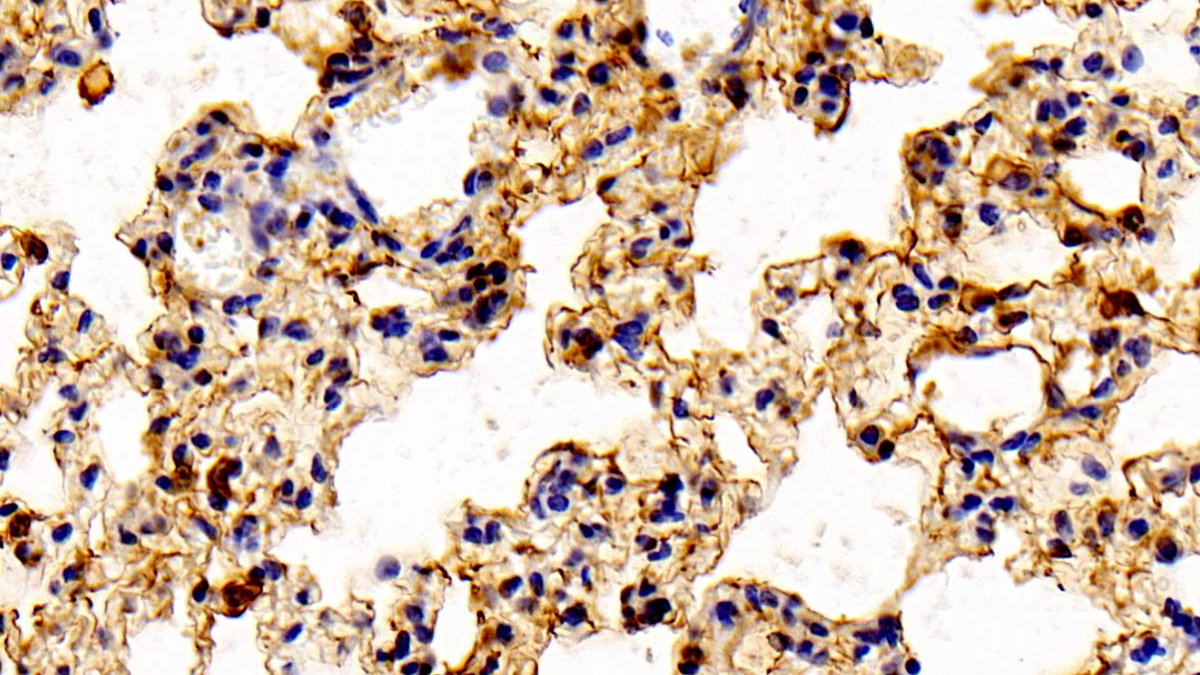 Polyclonal Antibody to Annexin A1 (ANXA1)