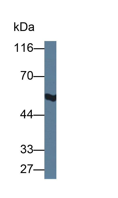 Polyclonal Antibody to Aldehyde Dehydrogenase 1 Family, Member A1 (ALDH1A1)