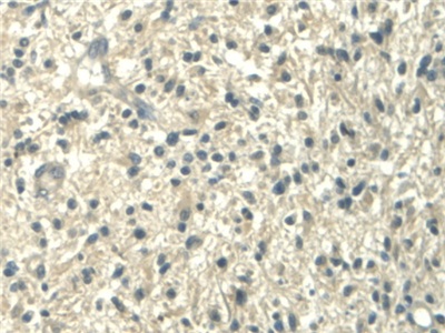 Polyclonal Antibody to Aldehyde Dehydrogenase 1 Family, Member A2 (ALDH1A2)