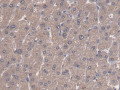 Polyclonal Antibody to Aldehyde Dehydrogenase 3 Family, Member A1 (ALDH3A1)